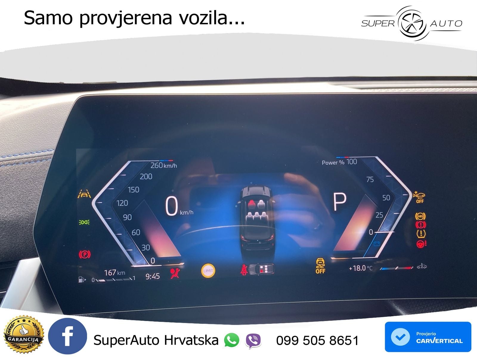 BMW X1 18i (136 KS) sDrive Steptronic M Sport